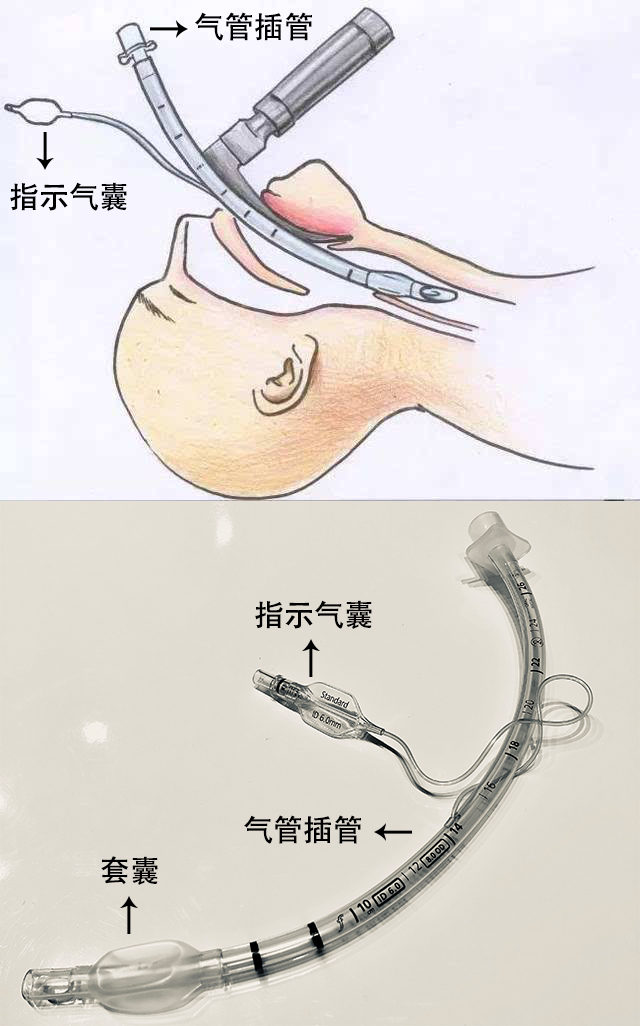 贊?。?！250萬指示氣囊，客戶100%滿意！